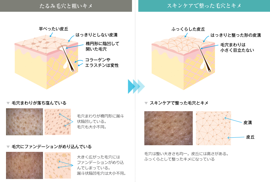 毛穴の比較画像