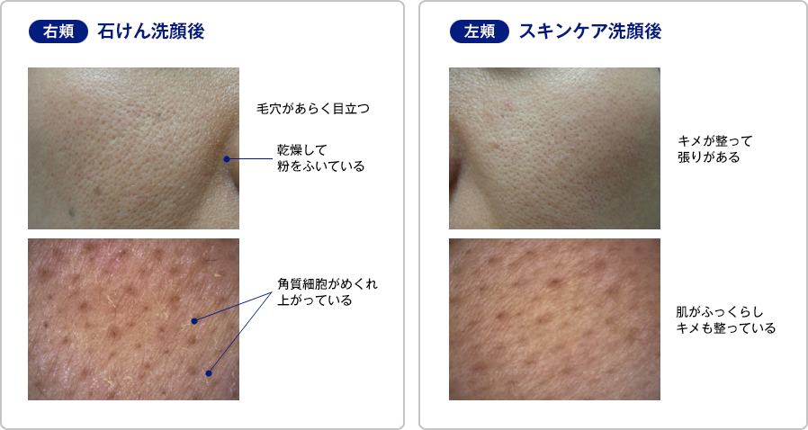 洗顔後の比較画像
